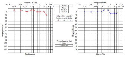 Audiogramm ohne Schwerhörigkeit